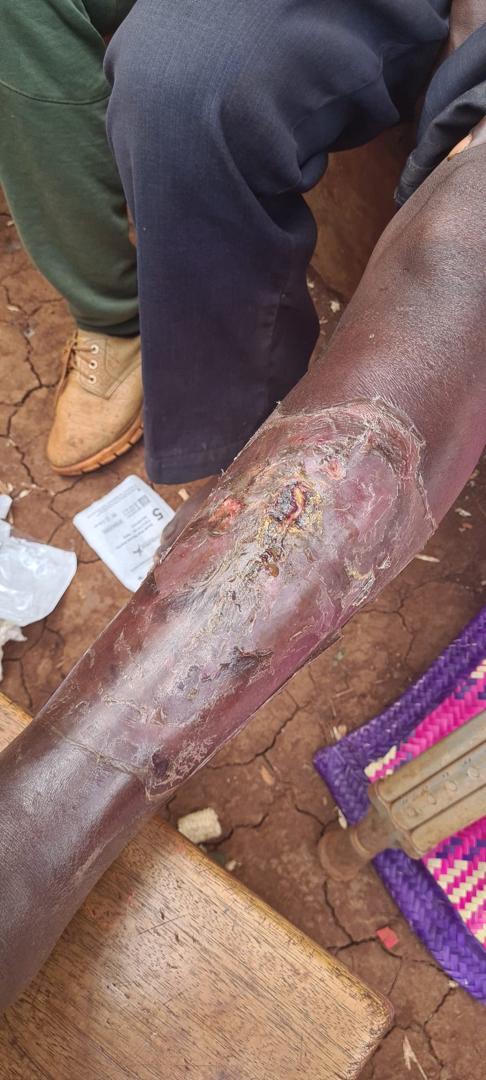 Treatment care 4 2023