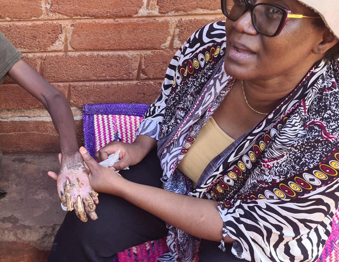 Treatment care 5 2023